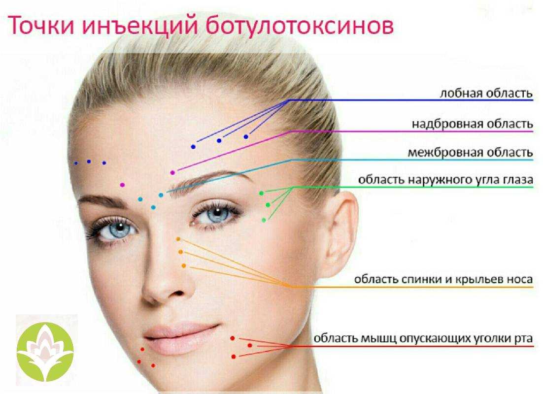 Морщины на лбу: альтернатива ботоксу и диспорту