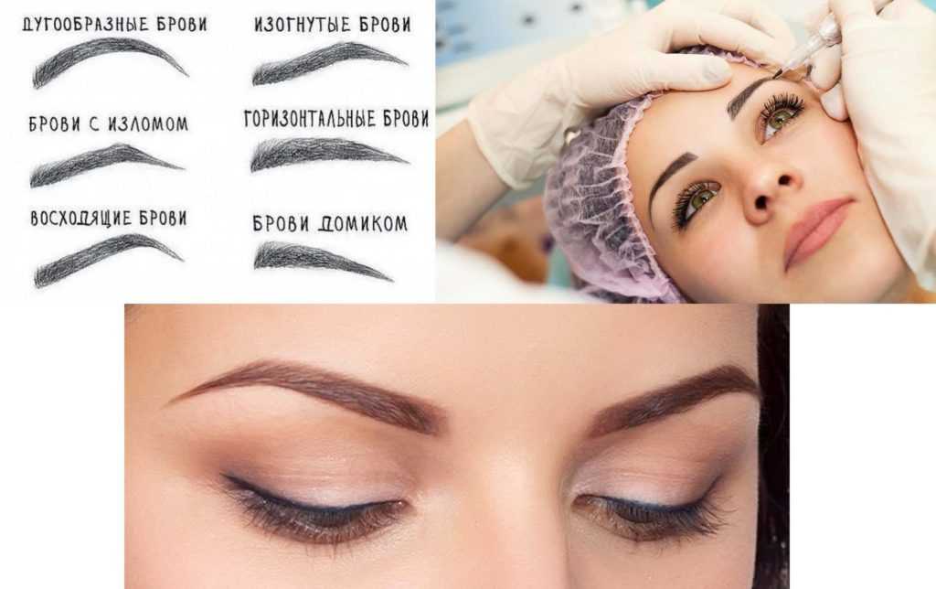 U magazine выяснил у эксперта все плюсы и минусы этой процедуры