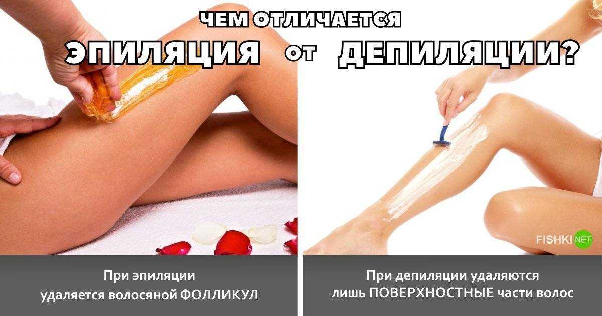 Вросшие волосы: как бороться после депиляции?