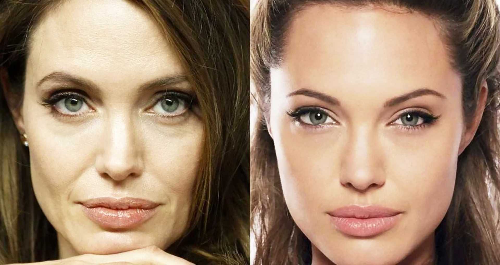 Анджелина Джоли носогубные складки