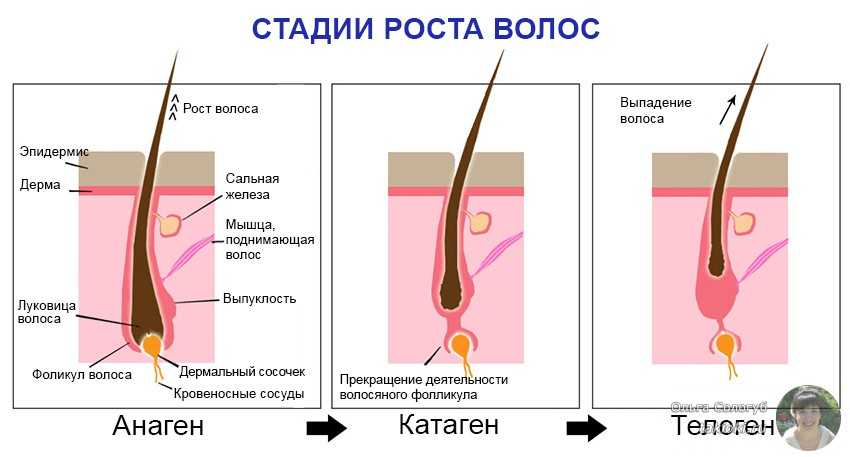 Трихотилломания (выдергивание волос) как психическое заболевание